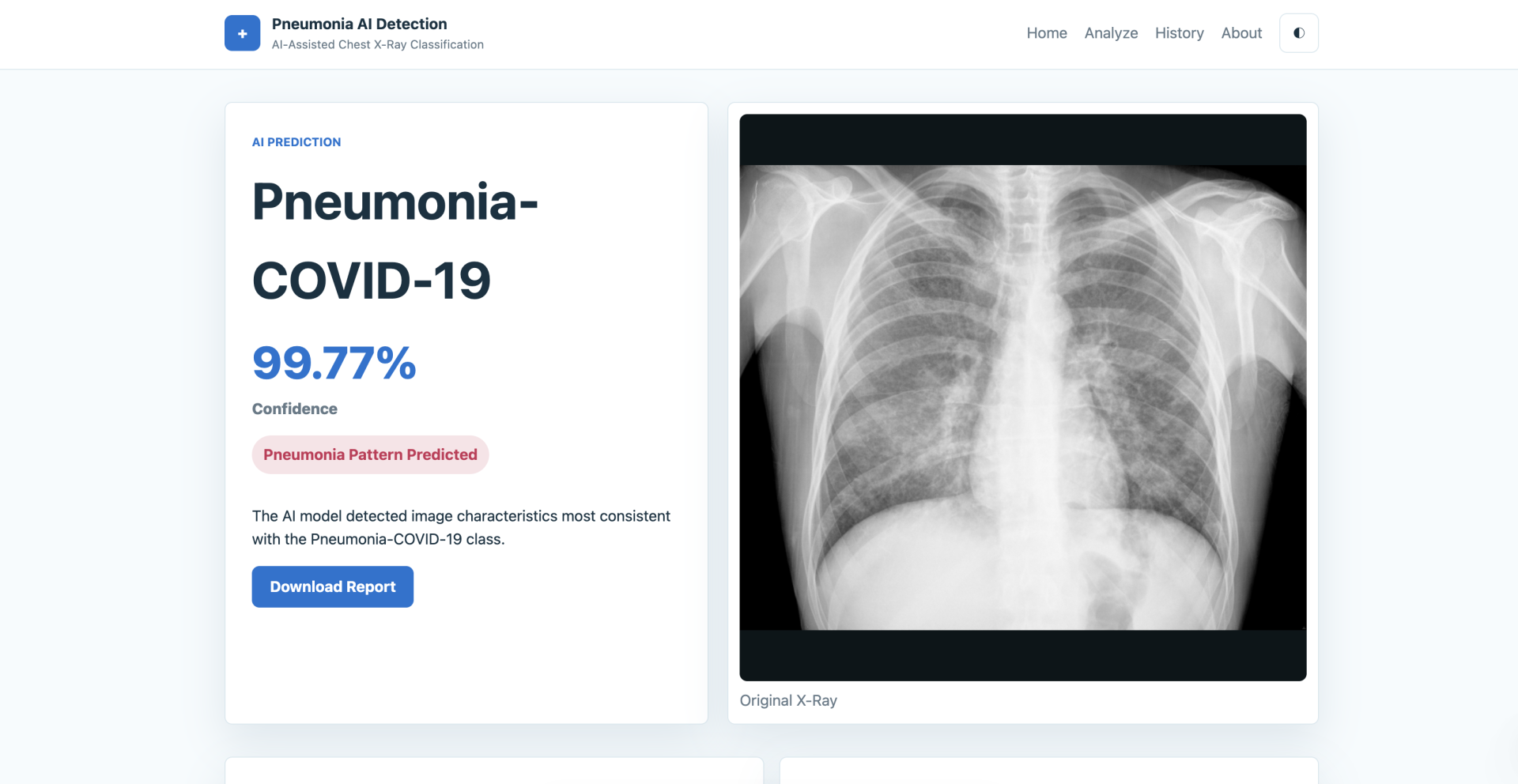 Deteksi Pneumonia